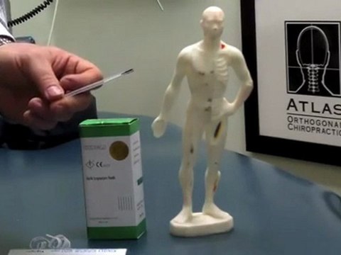 Chiropractor Centreville VA, Acupuncture for Pain Relief