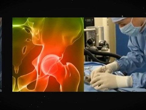 DePuy Hip Recall Lawsuit Is The Solution