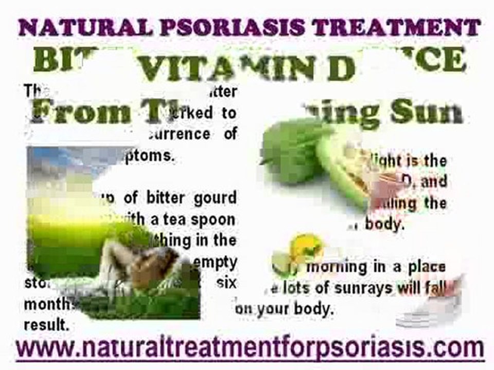 Natural Psoriasis Treatment Comprising Known Home Remedies