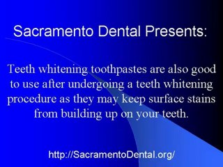 Sacramento Dental Does Teeth Withing Work