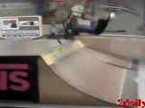 BMX Backflip FAIL