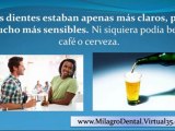 milagro dental remedio casero para blanquear los dientes