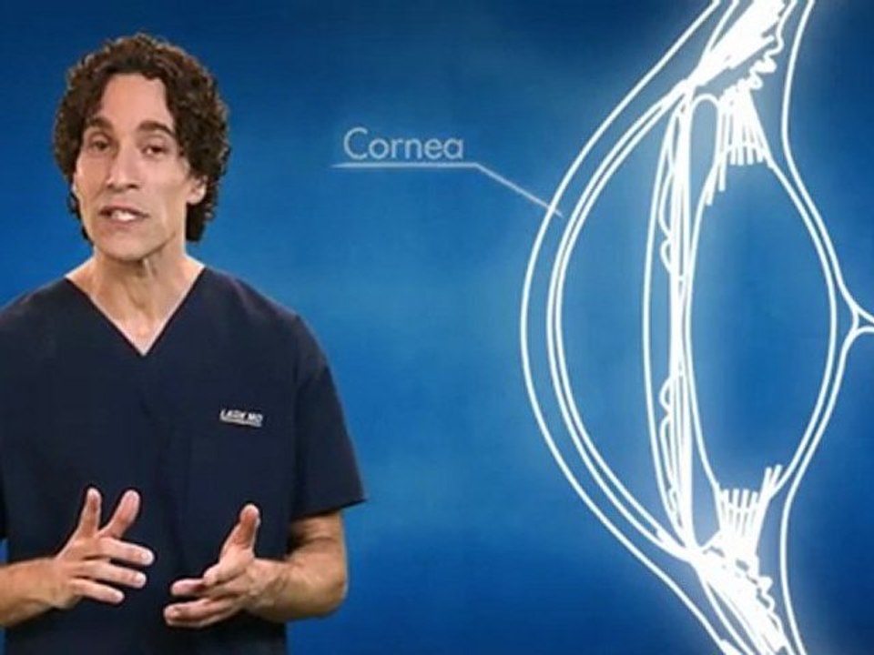 LASIK MD’s Dr. Avi Wallerstein explains “What is Laser Vision Correction”?