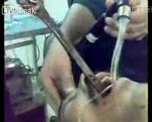 Что только не глотают