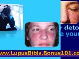 the lupus bible - what is lupus