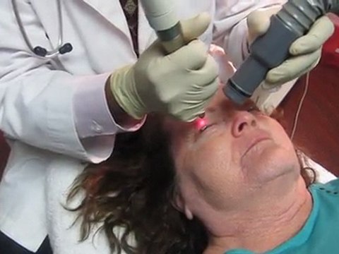 Facial Skin Resurfacing and Skin Tightening With Fotona Erbium Laser-Valey Aesthetics and Laser-626-961-7700