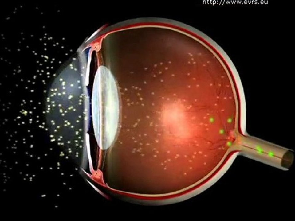 How does Vision Work ?