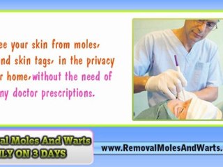 Download Video: Moles - Wart &Mole  Vanish - Face Mole