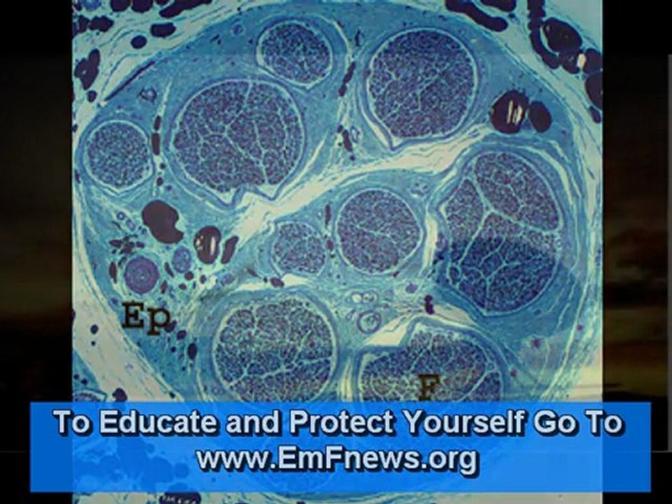 Using Microwave Radation in Schools - A Report By Barrie Trower Part 4