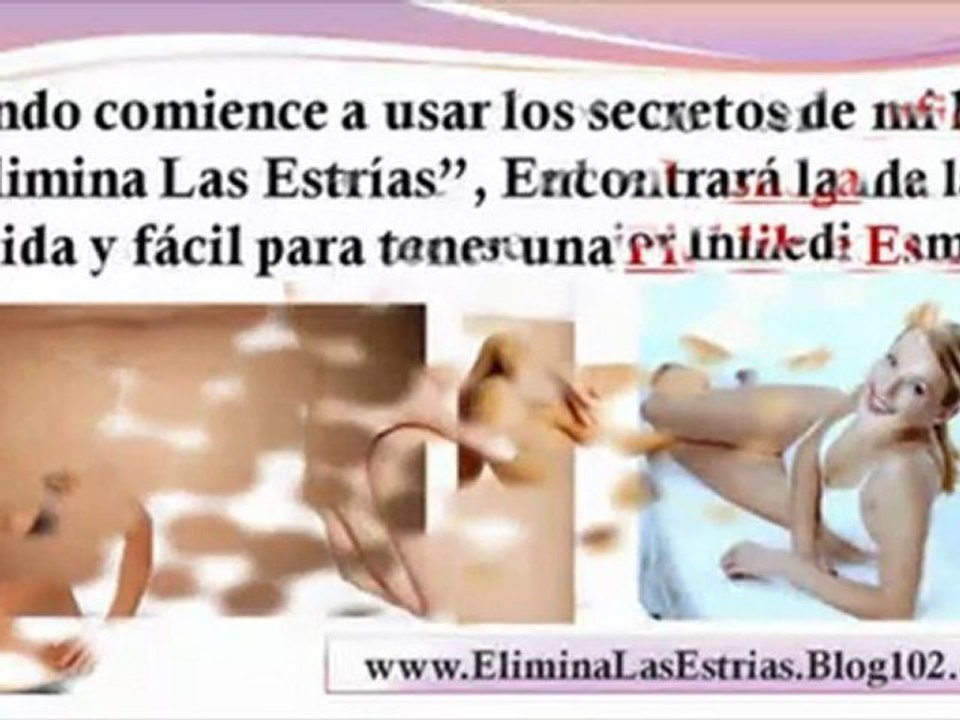 como desaparecer estrias - eliminar estrias blancas - como combatir estrias