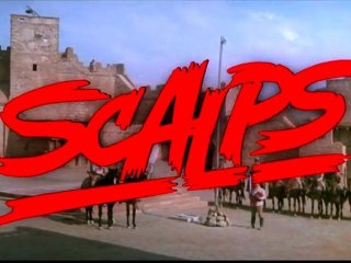 scalps (1)