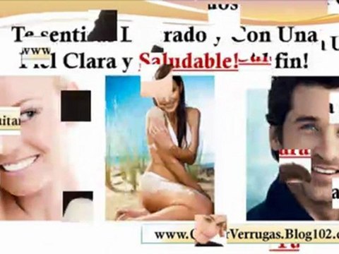 manchas oscuras en la piel - manchas negras en la piel - como eliminar verrugas