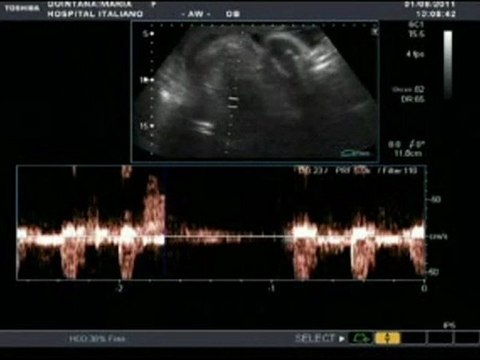 SIMON Y MATEO 01082011