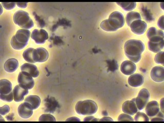 New Omega Wash Detoxifies Your Blood Of Infections And Viruses