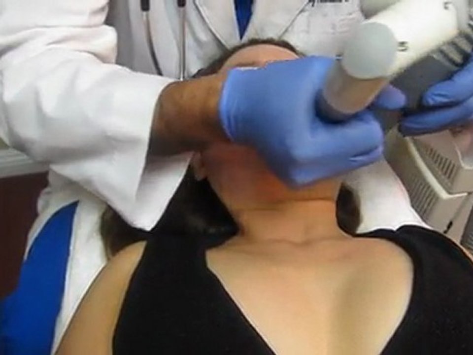 Erbium Micro Laser Peel- Los Angeles County-Orange County-Riverside County-San Bernardino County-Inland Empire-Anaheim-Fullerton-Beverly Hills-Pasadena-Burbank-Hollywood-Cerritos-Long Beach-Irvine-Costa Mesa-Orange-Brea-Whittier-Pomona-Chino-Fontana