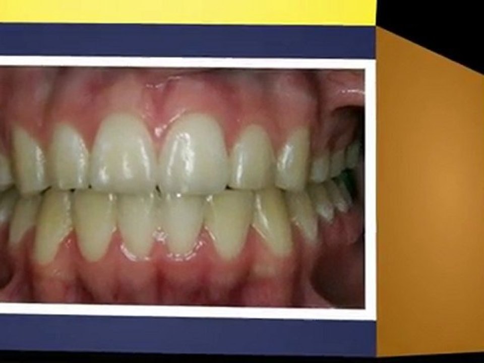 Orthodontist Aurora CO New Smiles July 2011