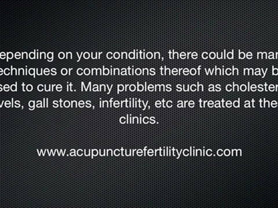 Arlington Acupuncture| All About Arlington Acupuncture