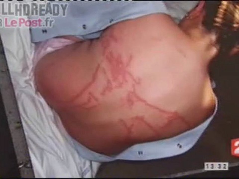 Invasion de "Meduses" sur la cote atlantique [NWS] FR02 090811