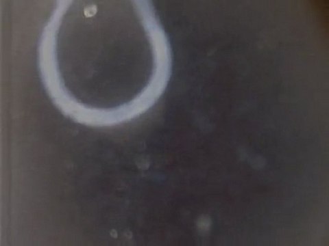 Cengiz Tamkan Haluk Yurdakul Plastik kolon borusu sonucu