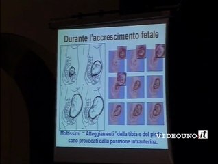 "La grazia delle gambe" - parla il pediatra Mimmo Tarantino