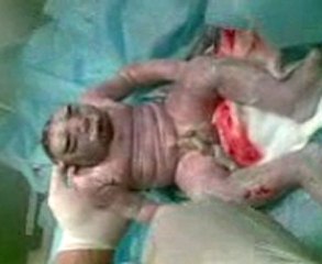 Menino nasce deformado