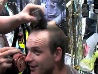 hair loss quick home remedies