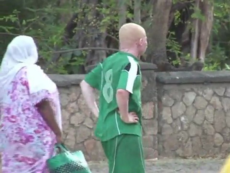 Arabic-Albinos unite through football
