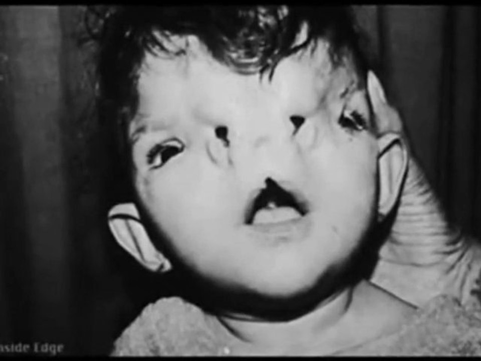 Tschernobyl Decay und deformiert (The Future of America)