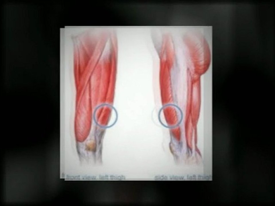 musculation cuisses