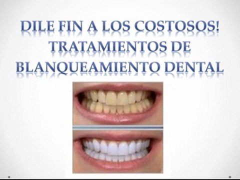 Como blanquear tus dientes