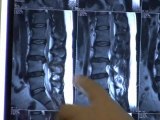Low Back MRI scan explaining low back pain, herniated and degenerated discs, & spinal decompression physical therapy & chiropractor treatment