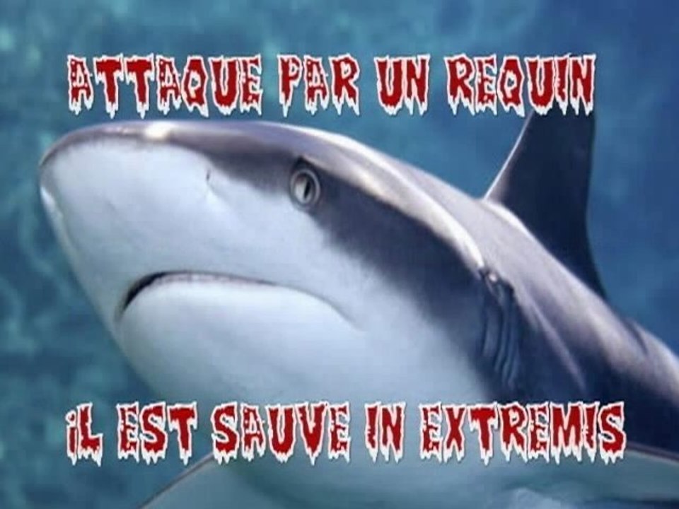 Un requin lui arrache les deux bras