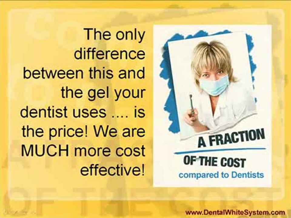 Affordable Teeth Whitening