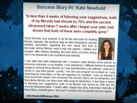 treatment for uterine fibroids naturally