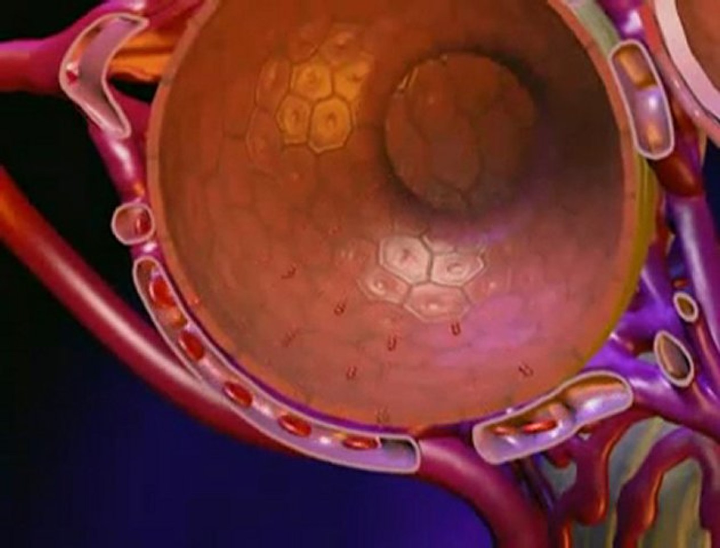 Lung Cancer