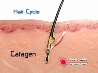HAIR CYCLE HAIR-LOSS