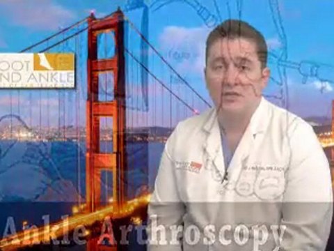 Ankle Arthritis - San Francisco Podiatrist Union Square CA