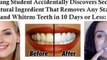 teeth whitening home remedies - how to whiten teeth at home