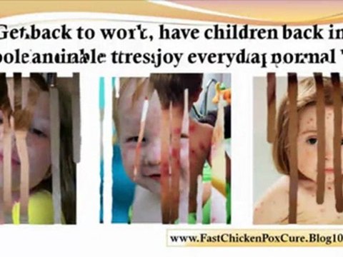 chicken pox symptoms in children chicken pox during pregnancy - adult chicken pox symptoms - how do you catch chicken pox