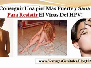 Download Video: tengo verrugas genitales como eliminar verrugas genitales - tratamiento para las verrugas genitales - verrugas genitales en mujeres