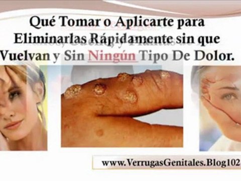 verrugas genitales en el embarazo fotos de verrugas genitales en mujeres - como se quitan las verrugas genitales
