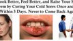 how to get rid of cold sores fast - how to get rid of cold sores
