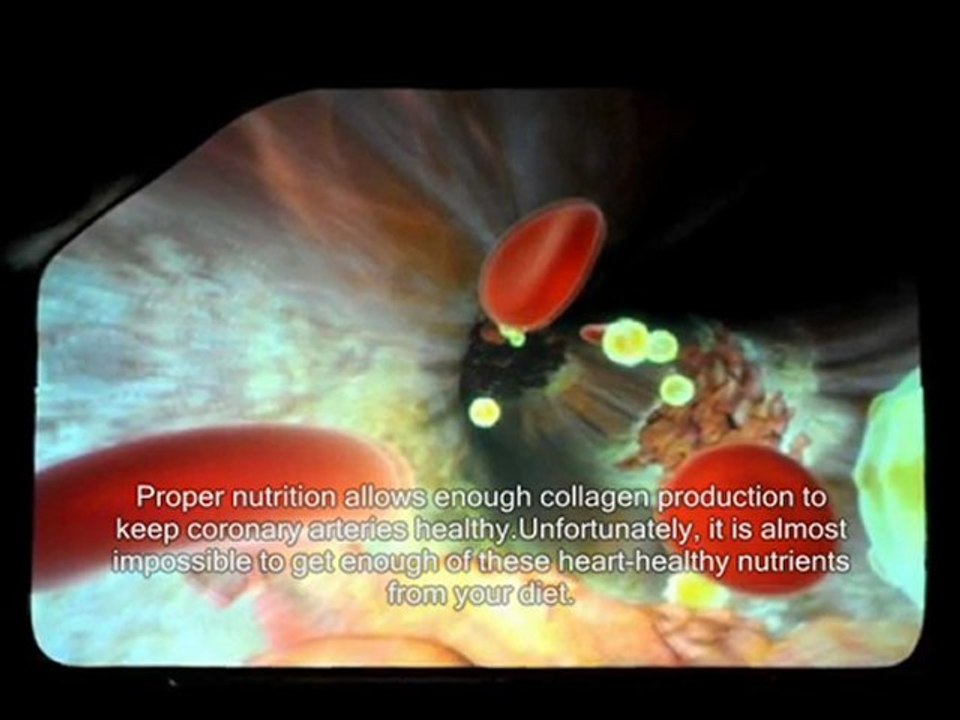 How to clean arteries of plaque