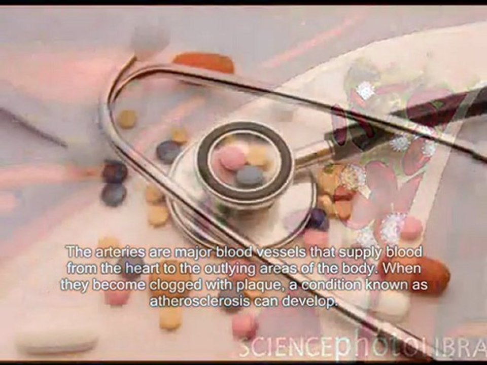 Clear arteries of plaque