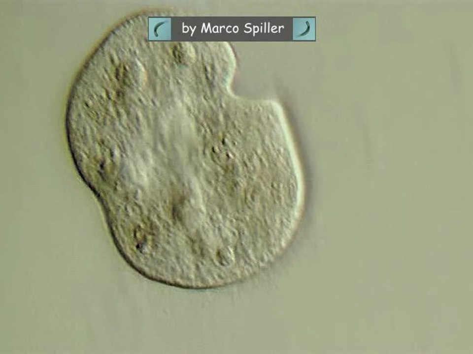 Colpoda cucullus
