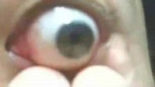 Eyeball Pop