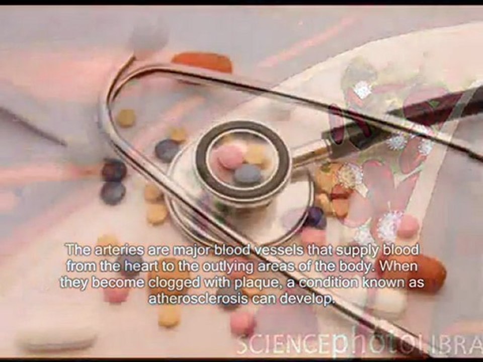 Clean arteries of plaque