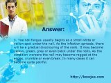 Kowjee's Health Tips - Toe Nail Fungus Answer 3