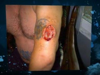 Problems With Steroid Products