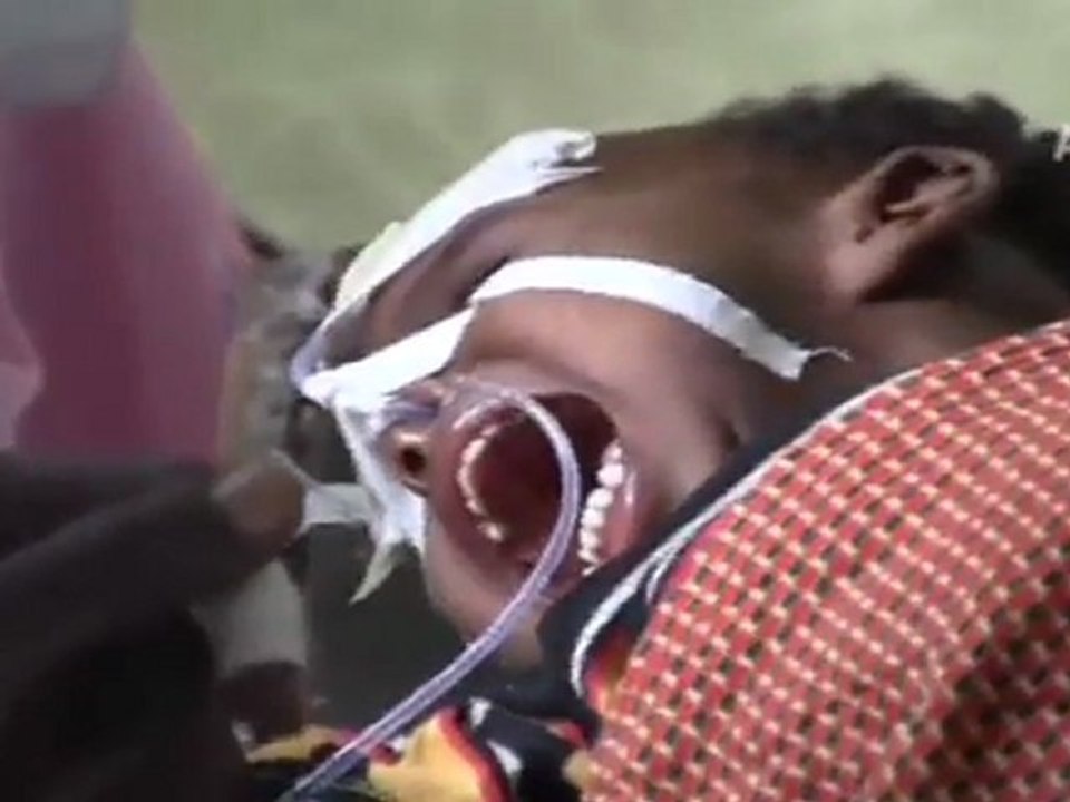 AA ekipleri sıcak bölgelerde